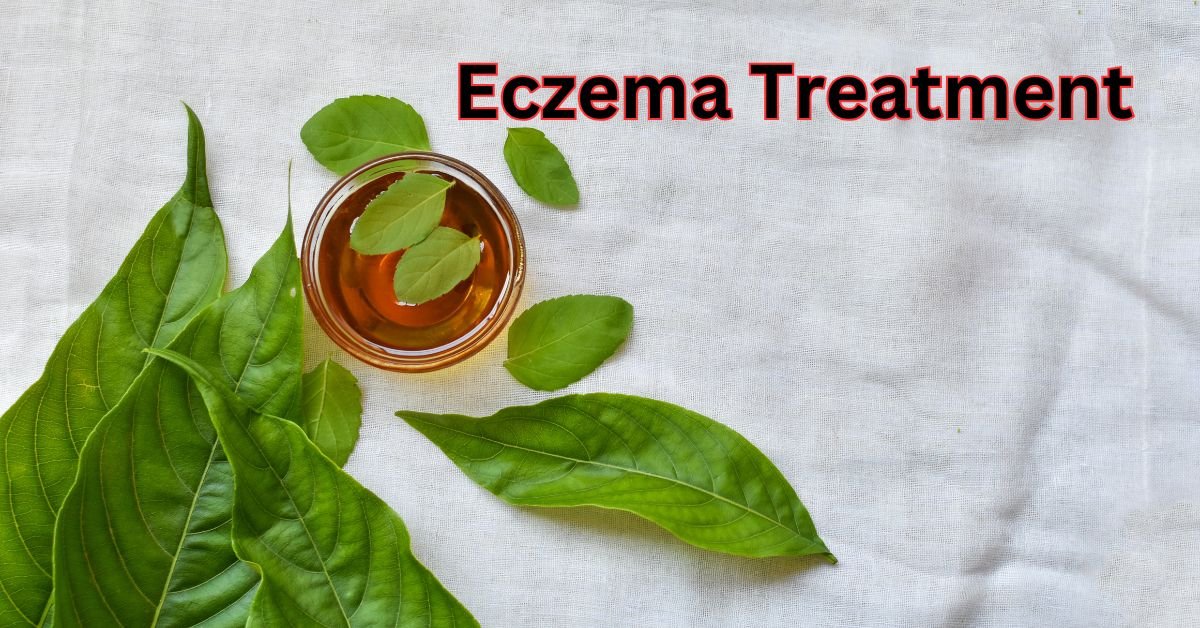 Eczema Treatment in Delhi