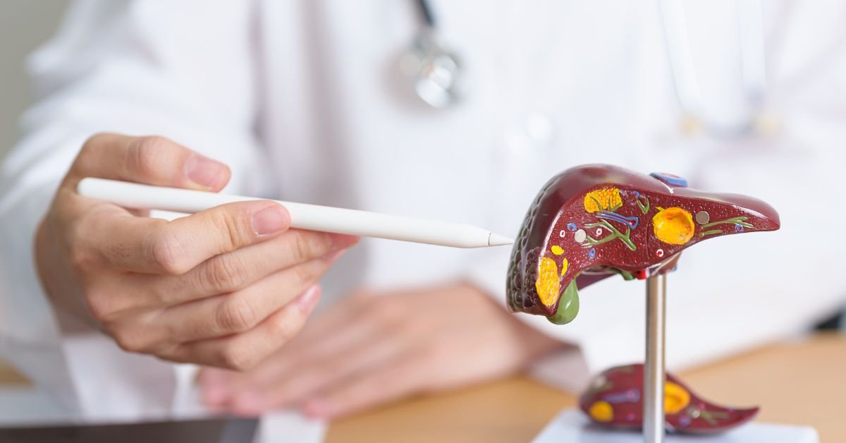 Fatty Liver Disease Treatment in Delhi